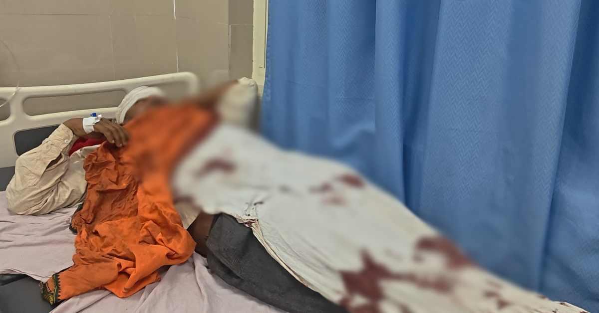 2 पक्षों के बीच जमकर मारपीट, 3 लोग घायल, पांच नामजद आरोपियों के खिलाफ मुकदमा दर्ज