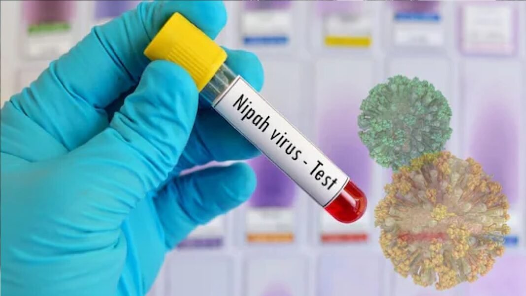 Nipah virus