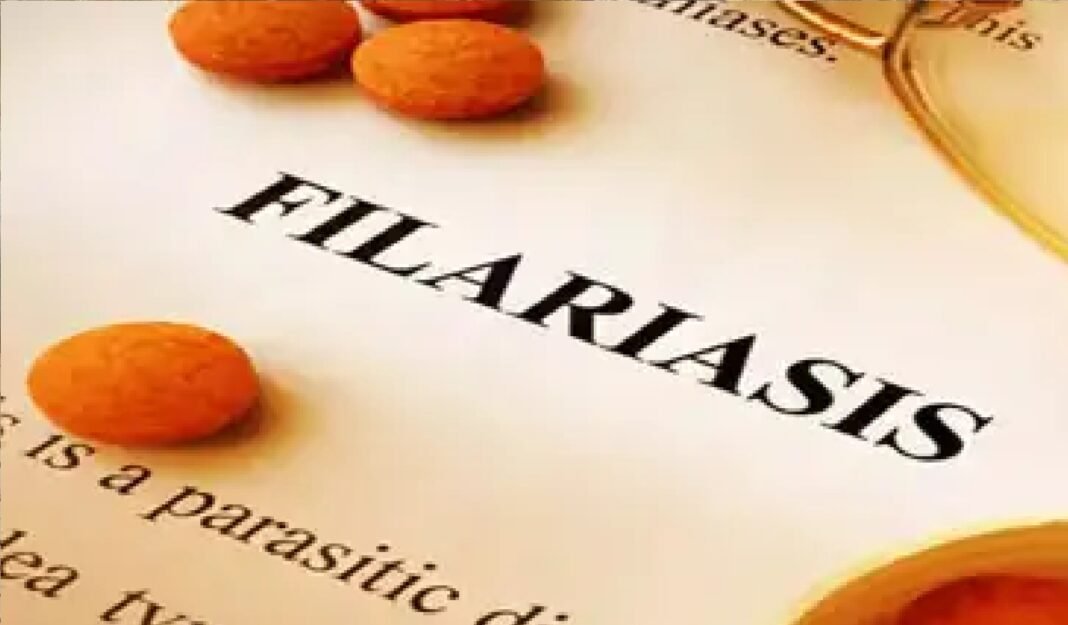 filariasis