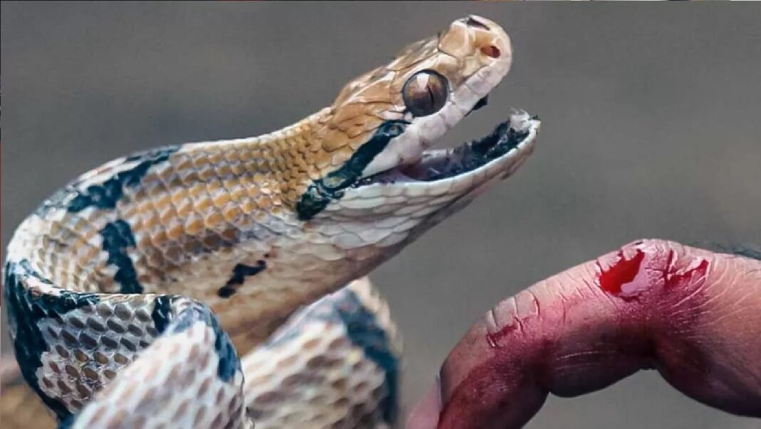 snake bite snake bite