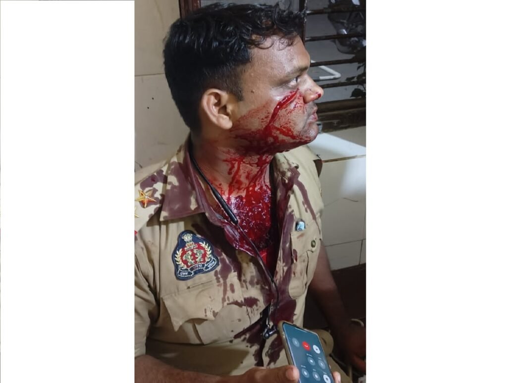 पुलिस टीम पर हमला