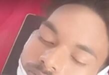 बाइक सवार पर बंदरों का कहर, दर्जनभर बंदरों के हमले में युवक गंभीर घायल