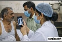 लोहिया अस्पताल में एक्स-रे फिल्म बंद, मोबाइल के सहारे इलाज; गरीब मरीजों की बढ़ी परेशानी