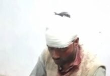 दीपावली की पुरानी रंजिश ने लिया हिंसक रूप: दो पक्षों में जमकर चले लाठी-डंडे, दो युवक गंभीर घायल; फायरिंग की अफवाह निकली झूठी