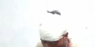 दीपावली की पुरानी रंजिश ने लिया हिंसक रूप: दो पक्षों में जमकर चले लाठी-डंडे, दो युवक गंभीर घायल; फायरिंग की अफवाह निकली झूठी