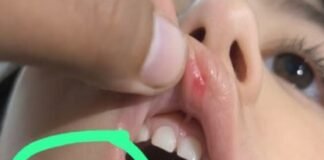 मासूम पर अत्याचार: शिशु कक्षा की बच्ची को टीचर ने पीटा, परिजनों ने लगाई न्याय की गुहार