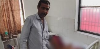 कुकर फटने से मां सहित चार झुलसे, बच्चे की हालत गंभीर