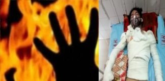 पेट्रोल के दाम को लेकर हुए विवाद में युवक को जिंदा जलाने की कोशिश, 37% झुलसा