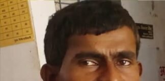 बंदर के हमले से युवक घायल, एंटी-रैबीज टीका लगाकर किया गया उपचार