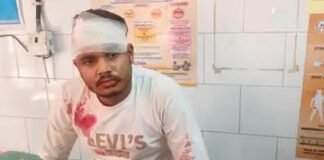 बघार में दो बाइकों की आमने-सामने भिड़ंत, दोनों युवक गंभीर घायल
